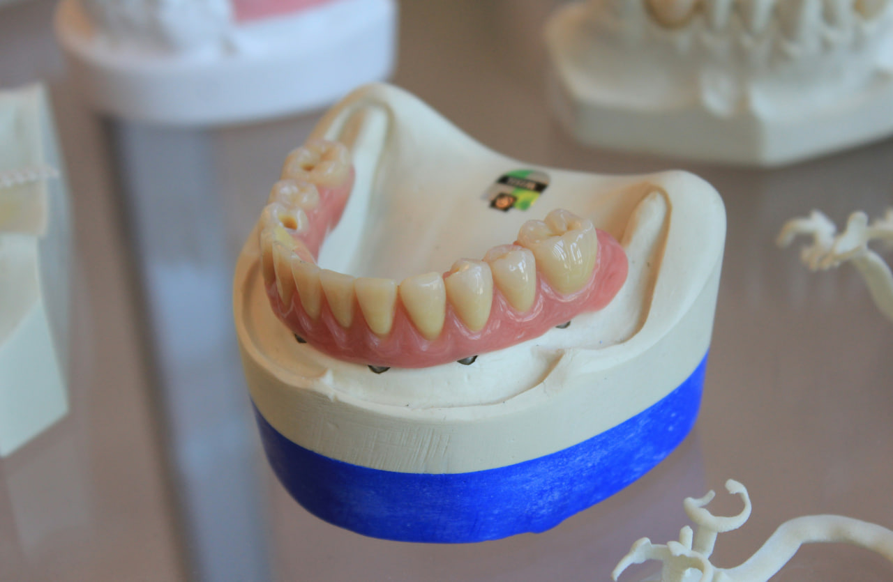 Og‘iz bo‘shlig‘i uchun eng kuchli himoya vositasi qaysi