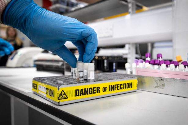 Kongo va qo‘shni davlatlarda Ebola xavfi kuchaymoqda: nimalar ma’lum